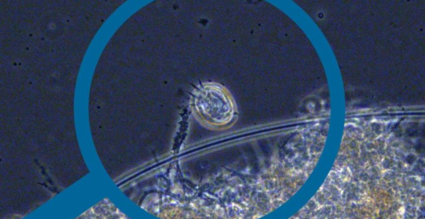 Wastewater Bug Spotlight Crawling Ciliate City of Santa Barbara